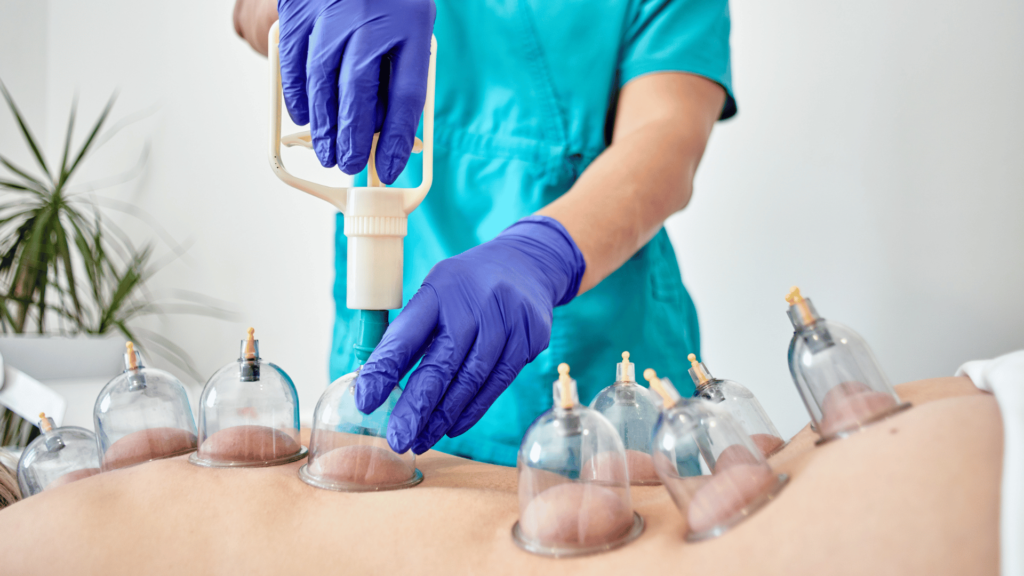 massage therapist doing cupping on a client